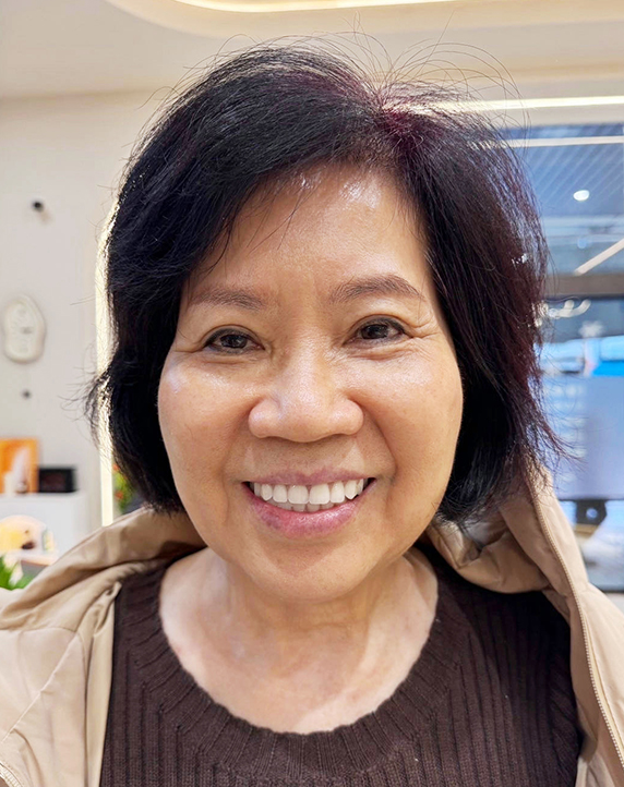 黃小姐術後照片